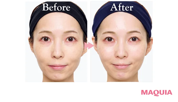 2026年おすすめブライトニング最新作 ポーラ ホワイトショット クリアスキンローション 使用後の変化