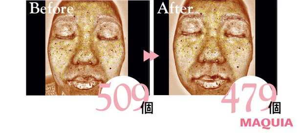 2026年新作スキンケアコスメ Obagi オバジC25セラム NEO 表面下のシミの個数の変化