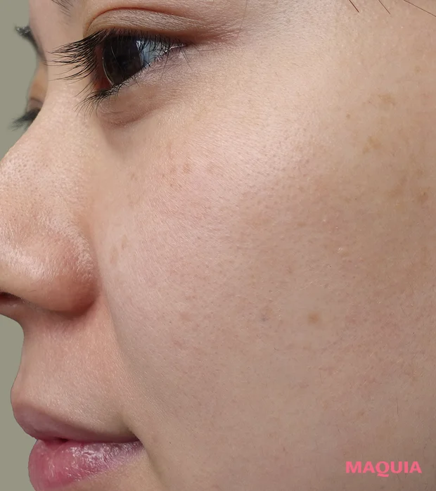 クリアターン ごめんね素肌 キニシナイパッチ　レビュー