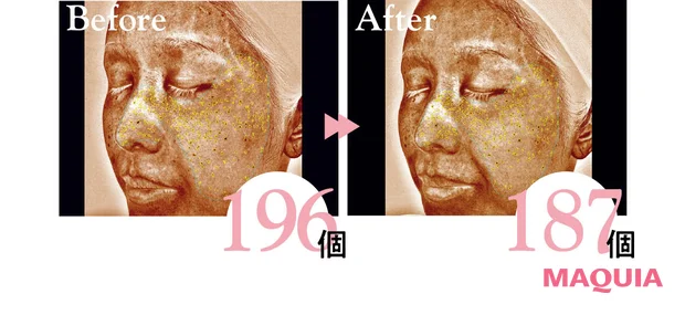 2026年最新作 おすすめブライトニングスキンケアコスメ TAKAMI タカミブライト スポットB3＋ 表面下シミの個数の変化