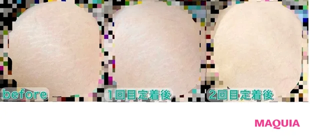 肉割れ、アートメイク