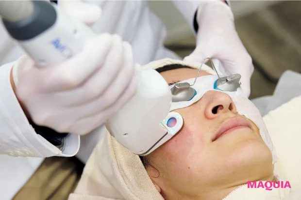 皮脂過多による「開き毛穴」に効くお手入れは？ ビタミンC＆摩擦レスの“攻めないケア”が正解_6