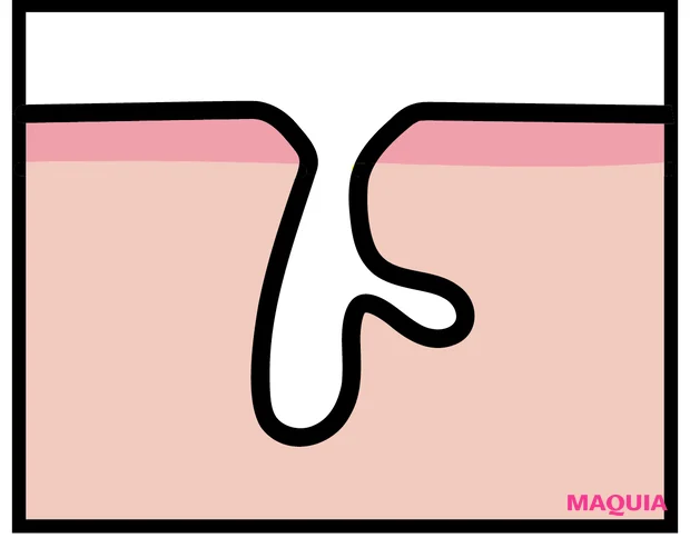 「乾燥による開き毛穴」は最新コスメで応戦! 洗顔・美容液・クリームのおすすめをチェック_2