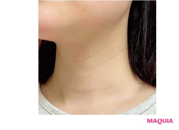 目元だけではなく首のシワにもよさそう