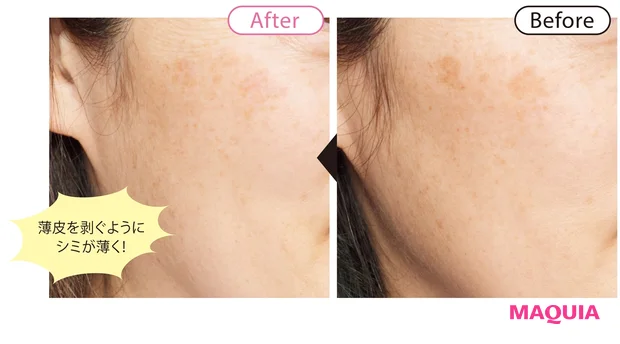 before/after 5
