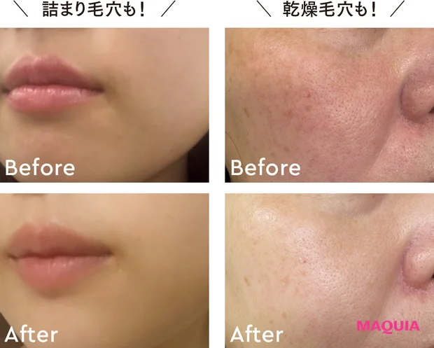 大人の毛穴悩みに向き合うバームが大人気【ここだけの話 第6回 パーフェクトワンフォーカス スムースクレンジングバーム】
_3