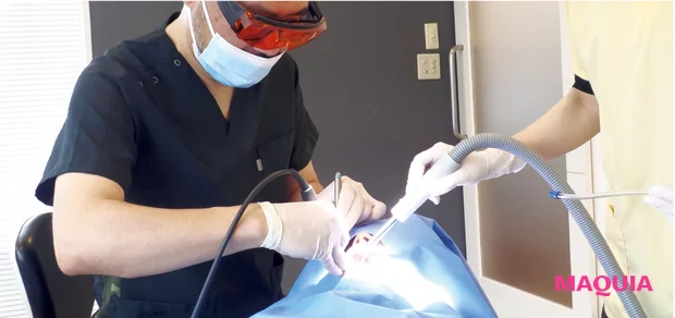 歯周病の事実 最先端治療 ブルーラジカル 施術の様子