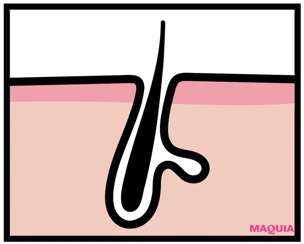 「頑固な黒ずみ毛穴」のおすすめ成分、NGケアをレクチャー。なかなか落ちない場合は産毛の可能性も？_4