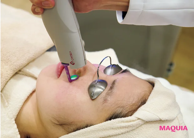 炎症による「ダメージ毛穴」は鎮静が最優先! ビタミンCのシートマスクも有効_5