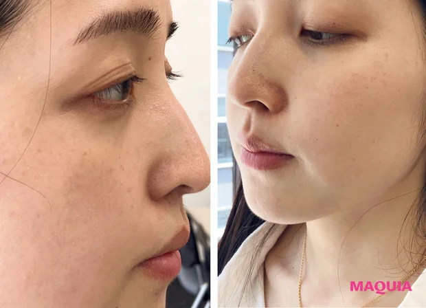 マキア 毛穴ケア 乾燥肌