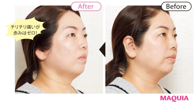 before/after 7