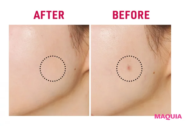 コンシーラーBEFORE/AFTER