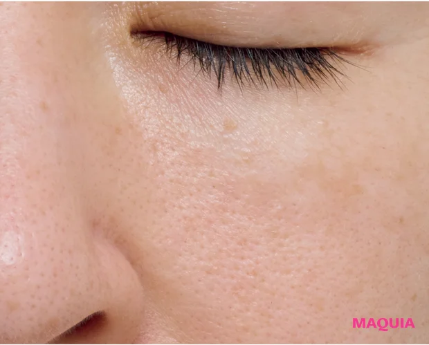 皮脂過多による「開き毛穴」に効くお手入れは？ ビタミンC＆摩擦レスの“攻めないケア”が正解_7_1