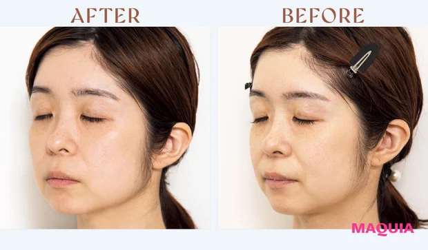 マキア　みんなのベスコス 2025年 上半期　オバジX ダーマアドバンスドリフト　レビュー