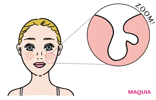 たるみ毛穴が現れやすいのは頬周辺。盲点なのが眉間。よく見ると眉間の毛穴が縦型になっているなんてことも。