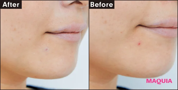 Before After