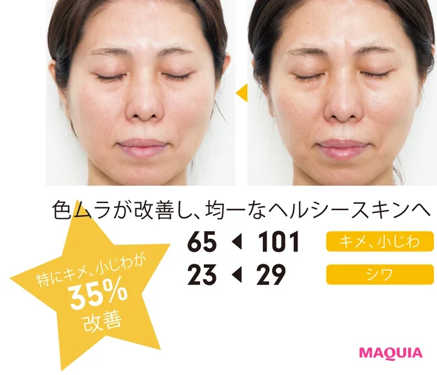 色ムラが改善し、均一なヘルシースキンへ