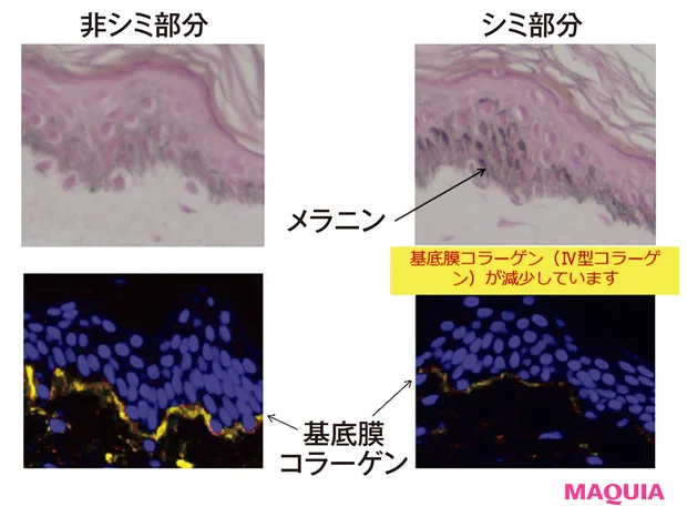 シミ部分は肌そのものが老化している!?