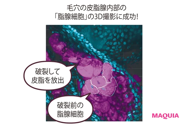 毛穴の皮脂腺内部の「脂腺細胞」の3D撮影に成功!
