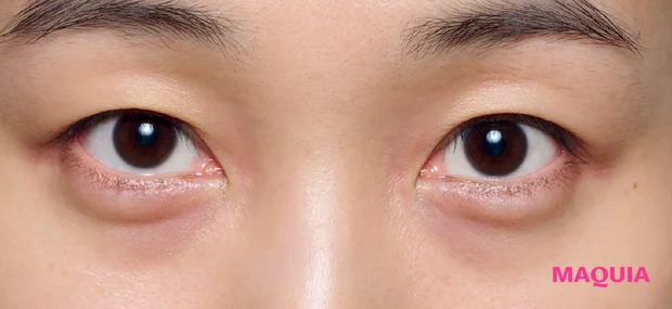 紫ぐま×たるみぐまタイプのくまカバー＆涙袋メイクのテクニック ビフォー