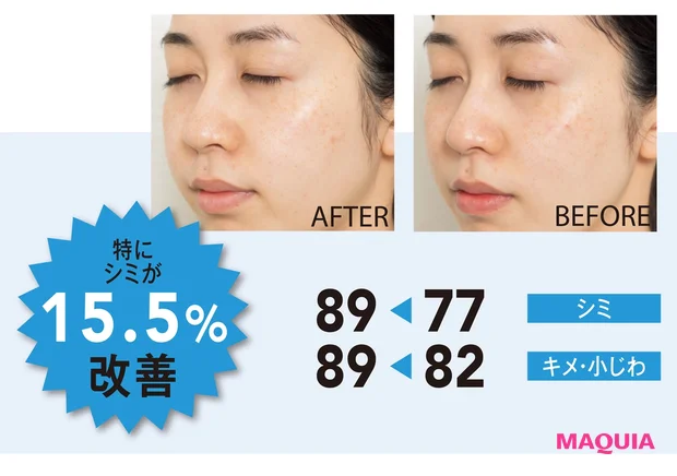 特にシミが15.5%改善