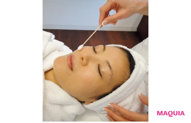 ダメージレベル1はピーリングを