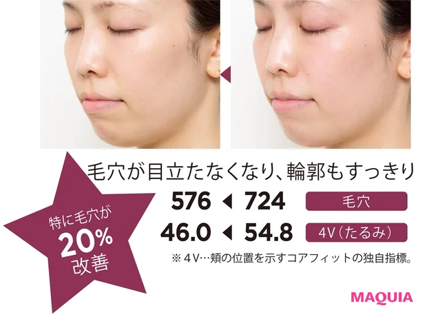 毛穴が目立たなくなり、輪郭もすっきり