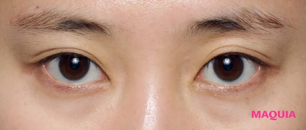 紫ぐま×たるみぐまタイプのくまカバー ビフォー