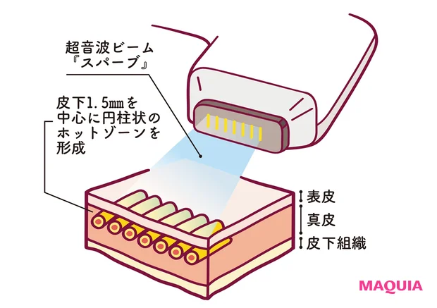 ソフウェーブの特徴
