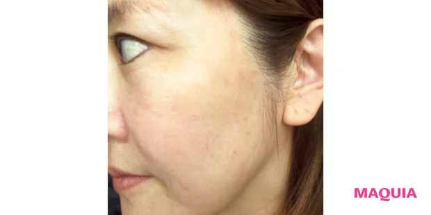 マキア　毛穴ケア　ピーリング　SISI アイムユアヒーロー モイストピールケアセラム　レビュー