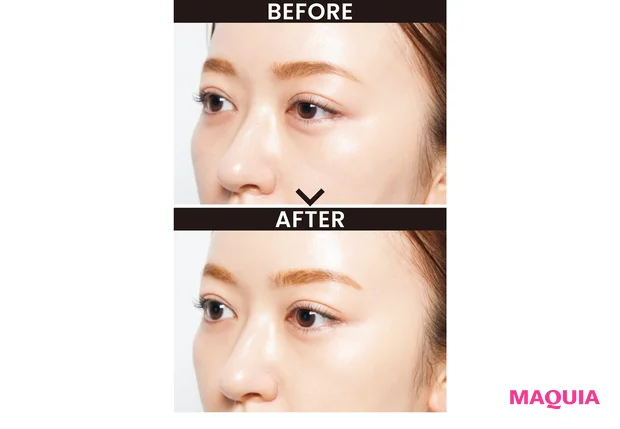 BEFORE/AFTER 6