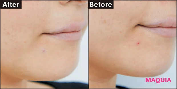 Before After