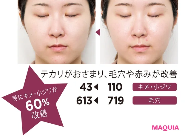 テカリがおさまり、毛穴や赤みが改善