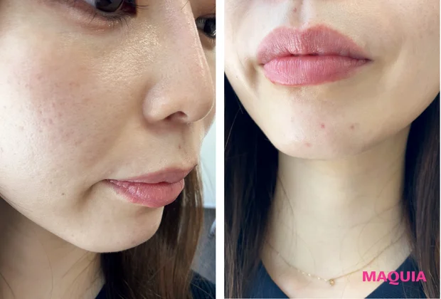 マキア 毛穴 皮脂 スキンケア 肌の状態 4