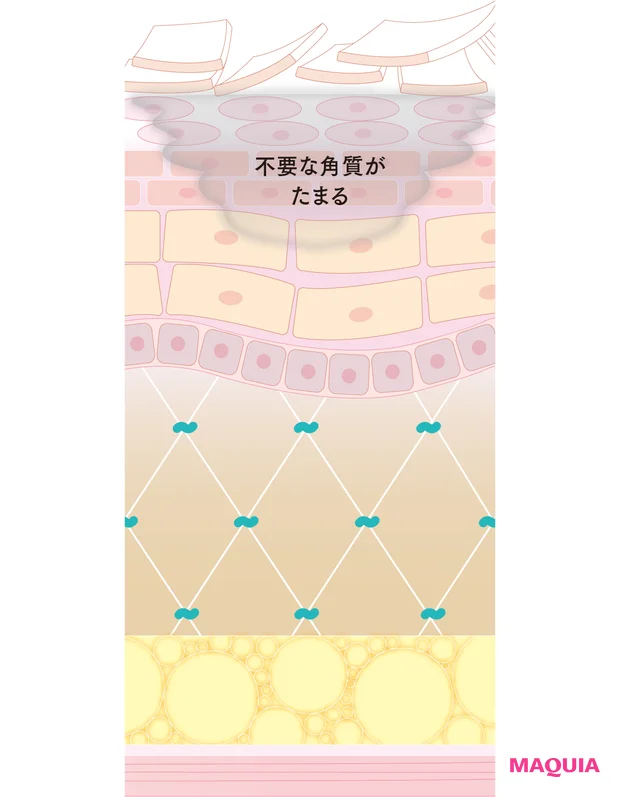くすみ肌のきっかけは? 何が起きている? メカニズムを医師が解説。おすすめコスメも伝授_3