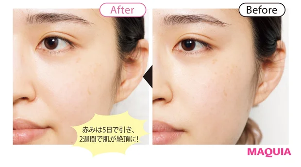 before/after 4