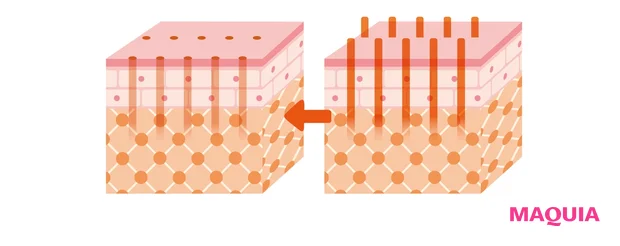 マドンナリフトの仕組み