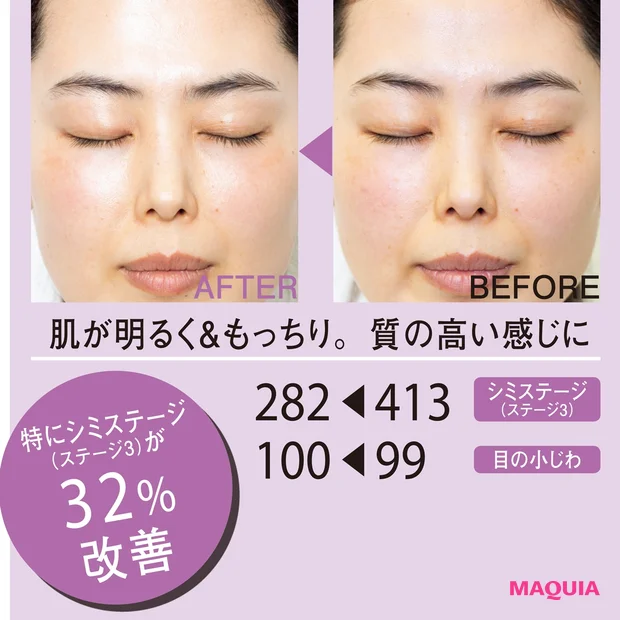 BEFORE/AFTER
