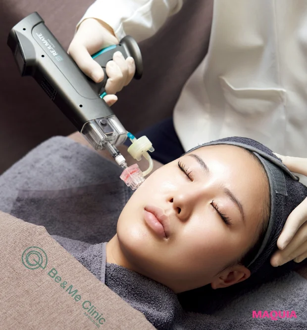 韓国現地のおすすめ美容医療 リジュラン 輪郭注射 ボトックス