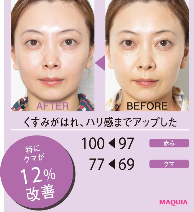 BEFORE/AFTER