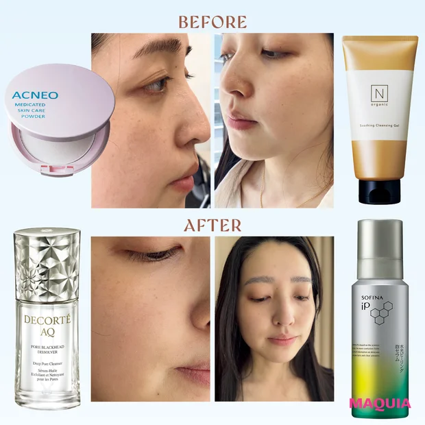 マキア 毛穴ケア N organic Basic スージング クレンジング ジェル シロク アクネオ