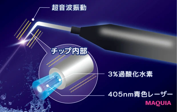 歯周病の事実 最先端治療 ブルーラジカル イメージ画像
