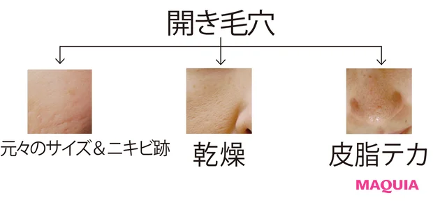 毛穴の開きが気になる プロが教える 皮脂テカ開き毛穴 の対処法 Maquiaメイク Line News