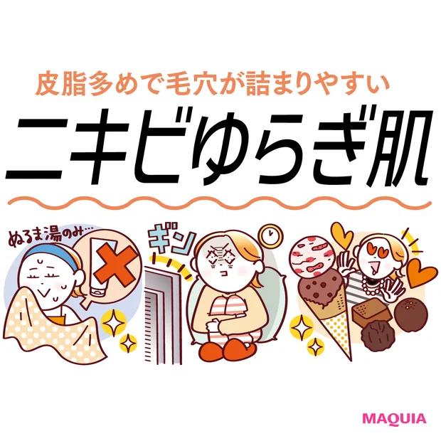 「ニキビができやすいゆらぎ肌」におすすめのスキンケア3選！食事の注意点もチェック