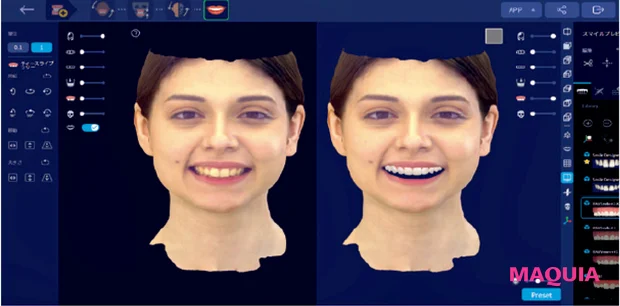 歯と口腔治療の最前線 オーラルケア 3Dフェイシャルスキャナー“RAYFace”