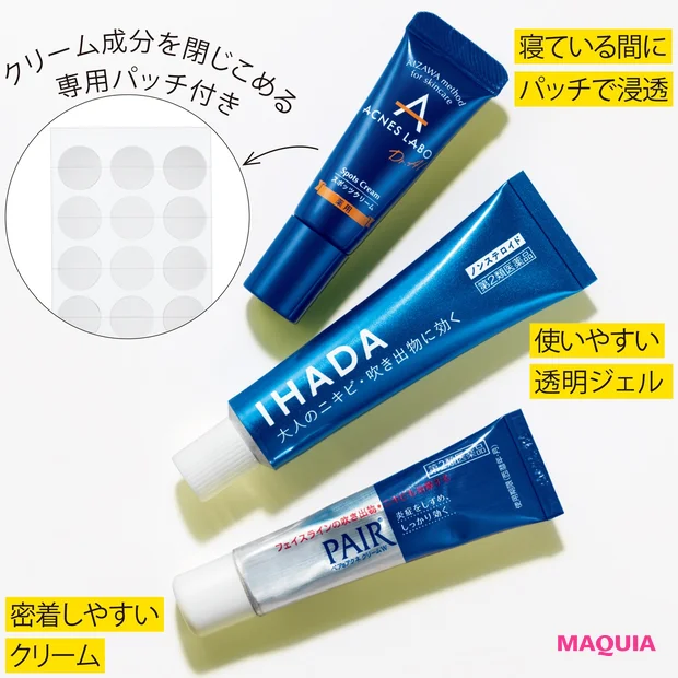 （上）アクネスラボ 薬用スポッツクリーム 夜用ポイントパッチ付き[医薬部外品] 7g ¥1380／ネイチャーラボ　（中）イハダ アクネキュアクリーム ジェルクリームタイプ治療薬 [第2類医薬品] 16g ¥800／資生堂薬品　（下）ペアアクネクリームW [第2類医薬品] 14g ¥950／ライオン