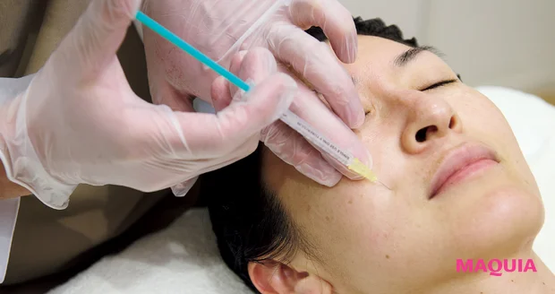 エイジングによる「たるみ毛穴」は、マッサージ&最新コスメでお手入れを。話題の「ジュベルック」体験記も_5