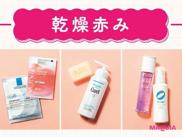 【肌の乾燥赤みQ&A】洗いすぎ注意！シートマスクも◎。対策法を皮膚科医が指南