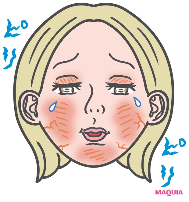 敏感肌の治安はどう守る？ 治安悪化のメカニズムから基本ケアを知って、今年こそ肌に平和を！