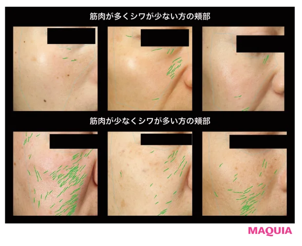 筋肉が多い人と少ない人のシワの比較